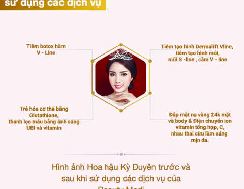 Hoa hau Ky Duyen noi doi bi tham my vien lat tay-Hinh-2